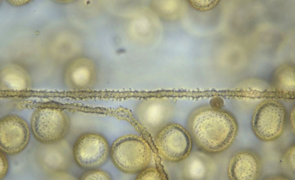 Perichaena depressa?